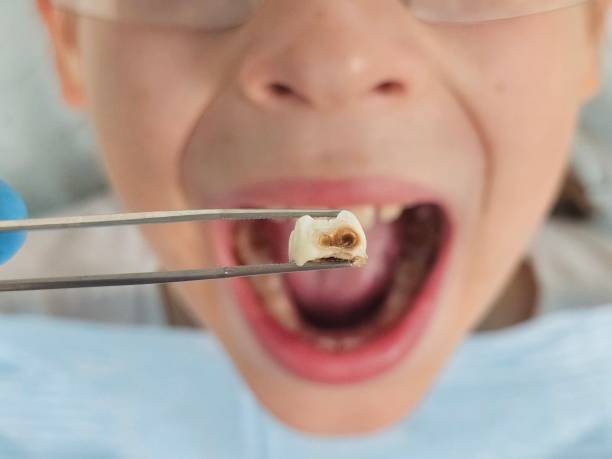 Best Emergency Pediatric Dental Care in Campti, LA